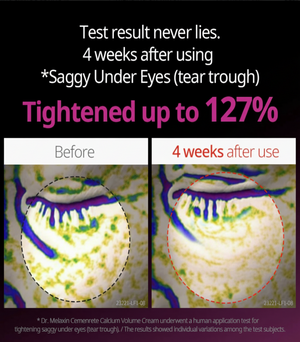 Pink Spicule Serum with Calcium Hydrating Set