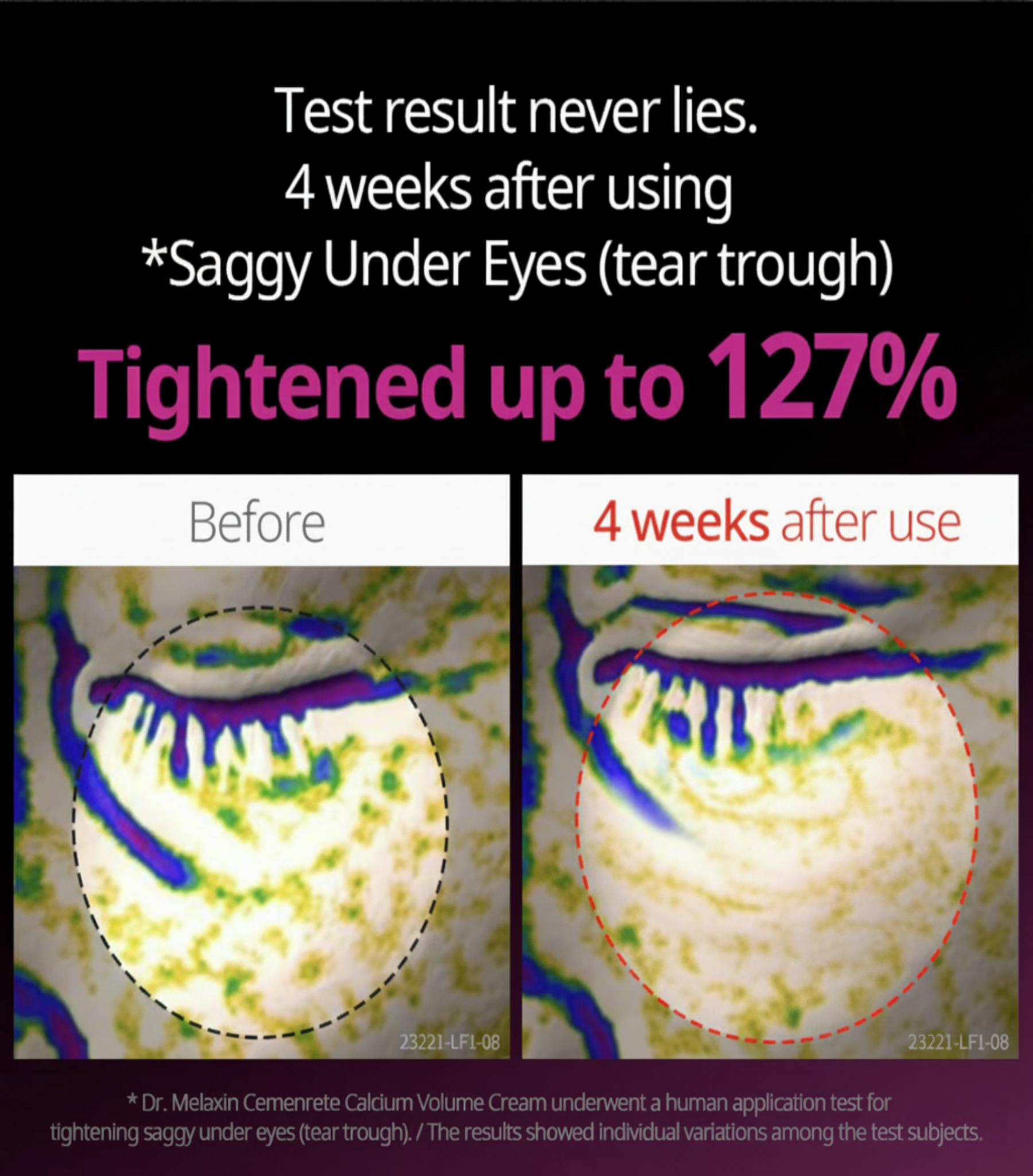 Pink Spicule Serum with Calcium Hydrating Set