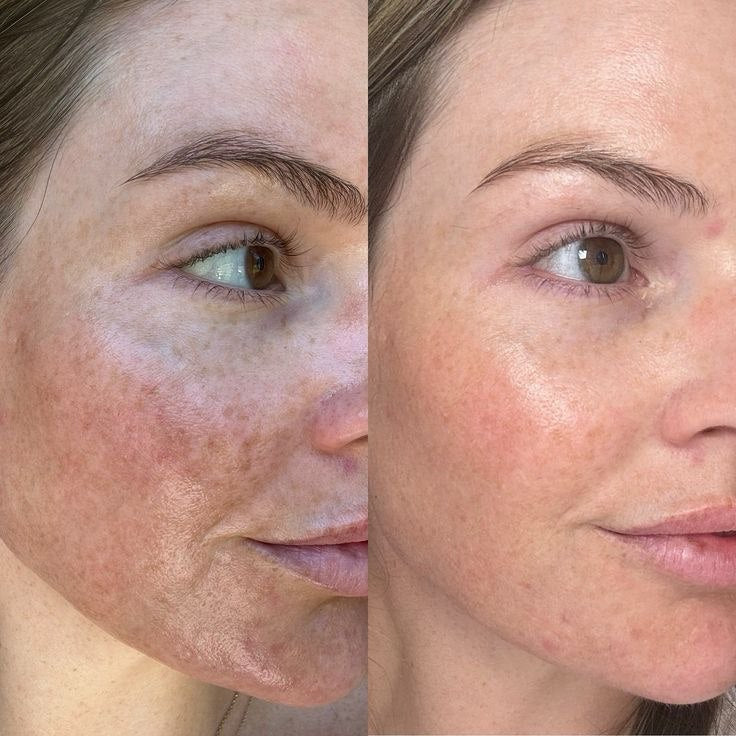 Dr. Melaxin Collagen Boost Set